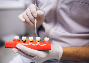 Ile kosztuje implant zęba w 2026 roku? Cennik, etapy, od czego zależy cena